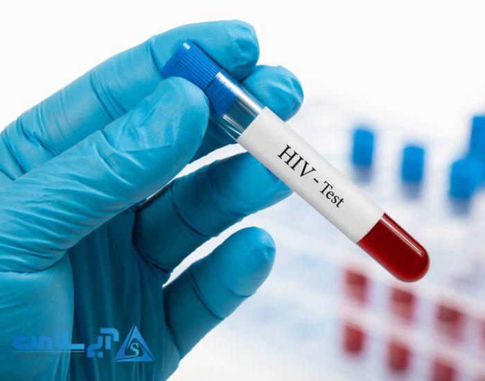 HIV چیست