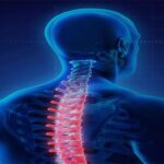 پوکی استخوان چیست و پیشگیری و علائم آن