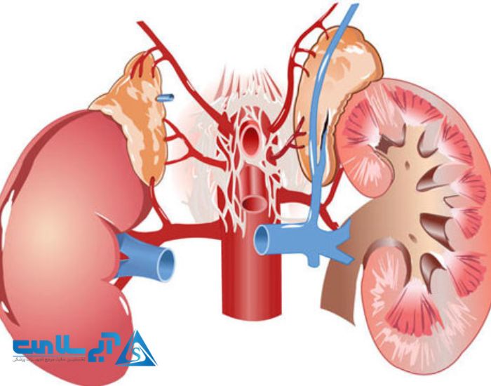انواع بیماری های کلیه