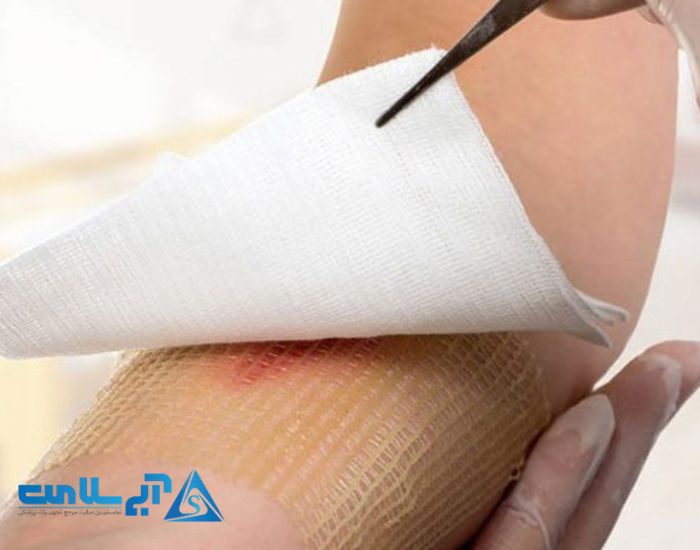 ترمیم زخم به روش مرطوب